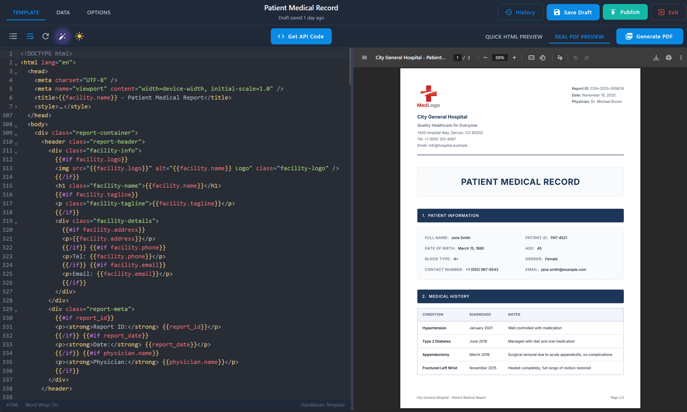 PDFBolt Handlebars template designer with code editor, syntax highlighting, and real-time PDF preview for creating dynamic templates